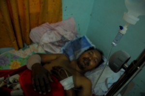 Hasbi (52), seorang tuna rungu,warga Desa Dedingin ,Kute Panang Aceh Tengah, sampai saat ini (7 Juli 2013) masih menjalani perawatan disalah satu ruangan RSU  Datu Beru, setelah menjalani operasi pemasangan pen. (Fauzi Ramadhan)
